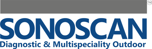 Sonoscan Logo